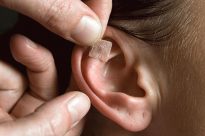 Acupuntura E Auriculoterapia No Tratamento Da Obesidade